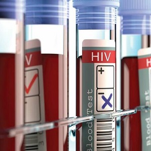 برای تشخیص محرمانه و رایگان "ایدز" به کجا باید مراجعه کرد؟