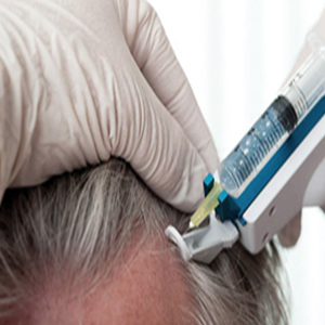 همه آن‌چه که راجع ‌به مزوتراپی مو باید بدانید