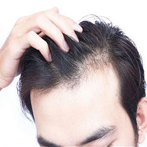 تفاوت ضایعات پوستی و ریزش مو ناشی از کرونا با سایر عوارض پوستی