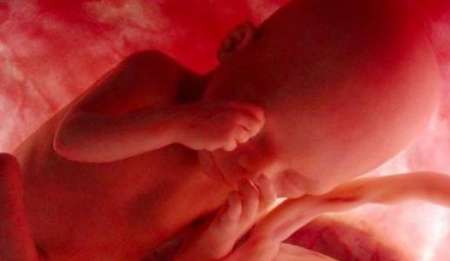 نگرانی‌ها از حذف غربالگری جنین برای چیست؟ / تولد سالانه ۳۵ هزار کودک معلول در ایران