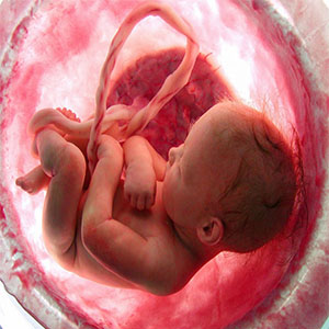 حذف غربالگری جنین باعث افزایش سقط‌های غیرقانونی می‌شود