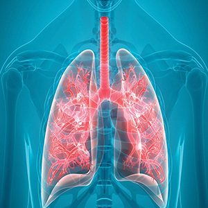 فیبروز ریه از علایم تا پیشگیری