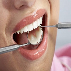 نکات طلایی آشنایی با رشته دندانپزشکی چیست؟