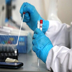 تشخیص ویروس های جهش یافته در آزمایشگاه بیمارستان امام