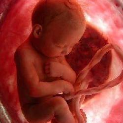 سقط جنین با افزایش خطر مرگ زودهنگام مرتبط است