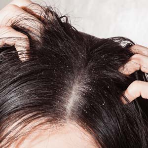 تصاویر | ۱۰ اشتباه رایجی که به موی شما آسیب می‌رساند