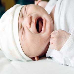 مهمترین علامت در نوزادان مبتلا به سندرم پیررابین مشکلات تنفسی است