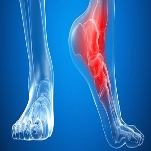تشخیص و درمان انواع مشکلات مچ، کف پا و زانو