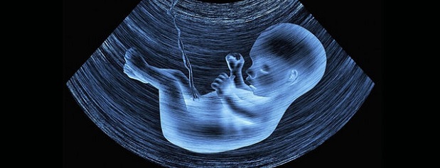 وزارت بهداشت: با طرح جدید مجلس درباره سقط جنین،۷۰ هزار ناهنجاری گریبان مردم را خواهد گرفت