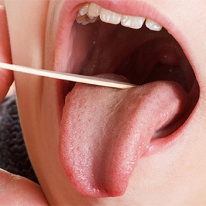 دو علامت در دهان که نشان از سطح بالای قند خون دارد