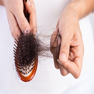 برای جلوگیری از ریزش مو چه باید بکنیم؟