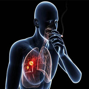 ورود ۷۰ ماده سرطان زا به بدن با مصرف سیگار