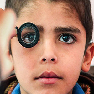 تاثیر کروناویروس بر بینایی کودکان