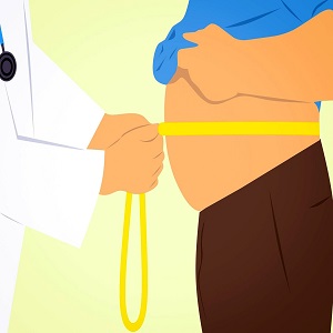 کدام بیماران برای درمان چاقی به جراحی نیاز خواهند داشت؟