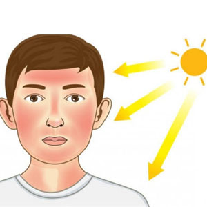 کار‌هایی که پس از ابتلا به آفتاب سوختگی نباید انجام داد