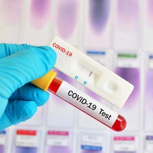 آخرین فهرست آزمایشگاه های تشخیص کووید 19 اعلام شد
