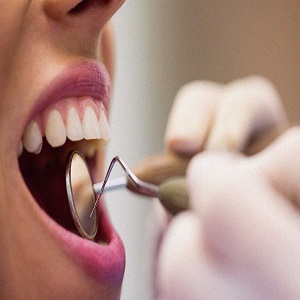 انتخاب دندان پزشک حرفه ای و متخصص