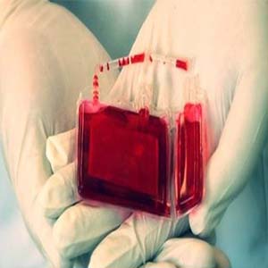 درمان ۷۱ نوع بیماری با خون بند ناف جنین