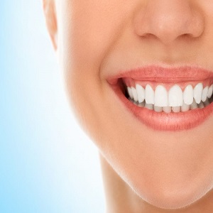 علاقمندی افراد به انجام لمینت دندان چیست ؟
