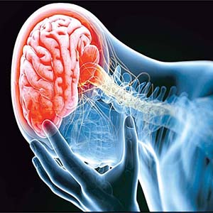 علائم و نشانه های «سکته مغزی ناقص» را بشناسید