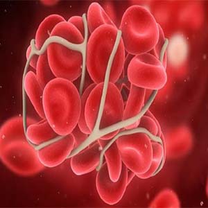 کشف پروتئین دخیل در لخته شدن خون