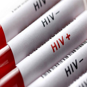 انجام بیش از ۱۰۰ هزار تست تشخیص ایدز در کشور